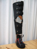 Orthopesieservice: beenbeugel