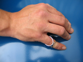 Orthopesieservice: zilverring